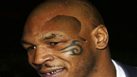 mike tyson face tattoo removed.